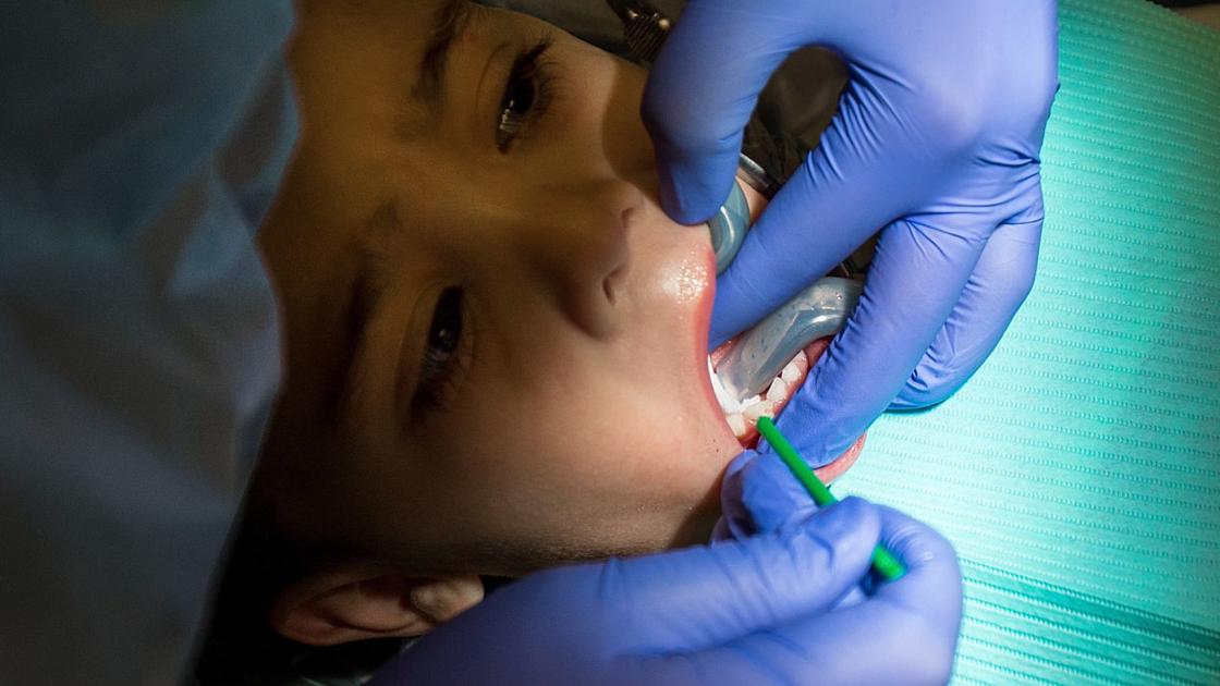 'Game changer': Brush-on liquid allows Tucson kids to avoid anguish of dental drill | Local news